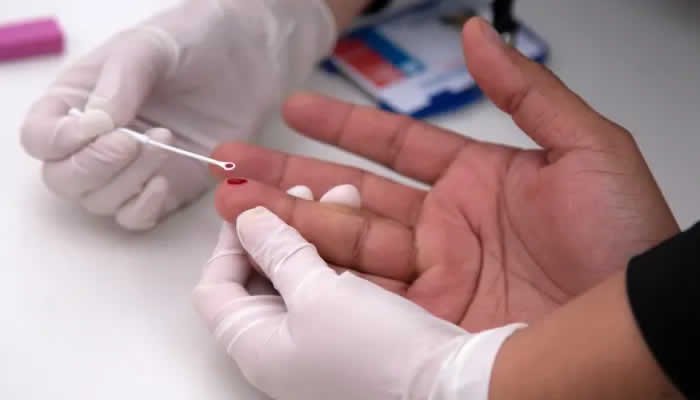 Colombia busca reforzarse contra el VIH