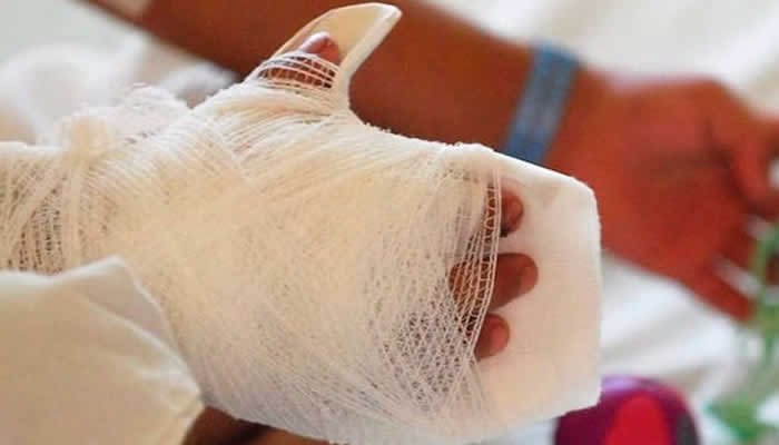 Cuatro quemados por pólvora en la noche de las velitas