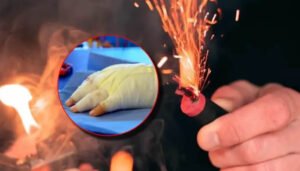 Aumentó porcentaje de lesionados con pólvora