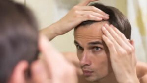 Alerta por capsulas ilegales contra la calvicie