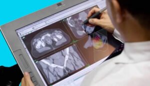 Inédito tratamiento contra el cáncer de próstata en Colombia