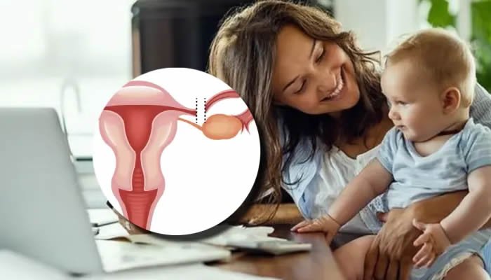 Corte Constitucional ordena evaluación de caso de ligadura de trompas