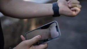 Nueva variedad de la viruela símica en Colombia