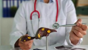 El 80 % de las personas con hepatitis B o C desconoce que tiene la enfermedad