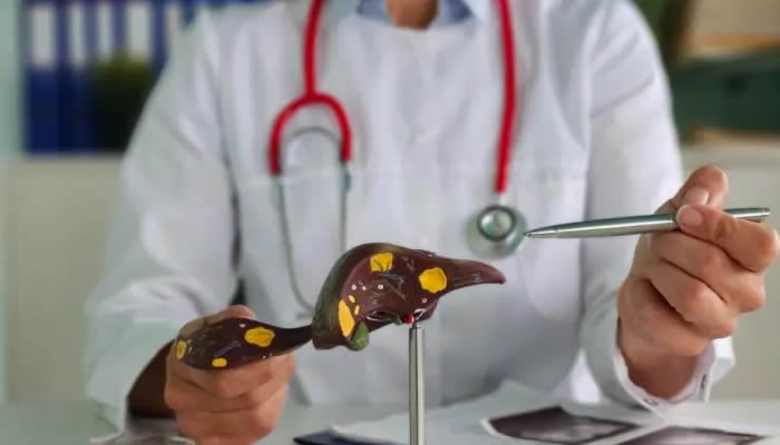 El 80 % de las personas con hepatitis B o C desconoce que tiene la enfermedad